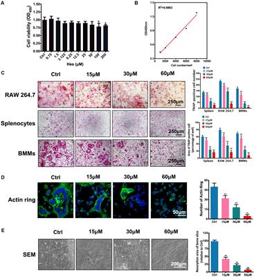 Hesperetin Prevents Bone Resorption by Inhibiting RANKL-Induced Osteoclastogenesis and Jnk Mediated Irf-3/c-Jun Activation